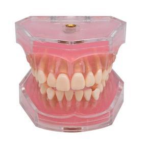 XHHDQES Dental Standard Model with Removable Teeth 4004 01 Dental Study Teach Teeth Model