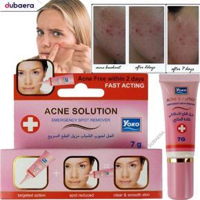 ACNE Solution Fast Acting Spot Remover cream - 7gm