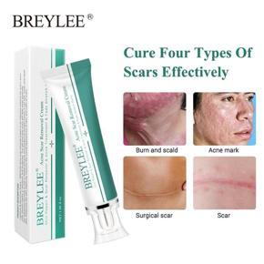 BREYLEE Acne Scar Removal Cream 30g