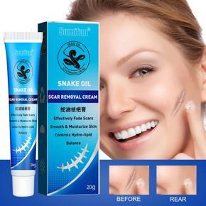 Snake Oil Ointment Remove Scar Cream Acne Treatment Hand Skin Face Care Natural Traditional Chinese Medicine Professional Design