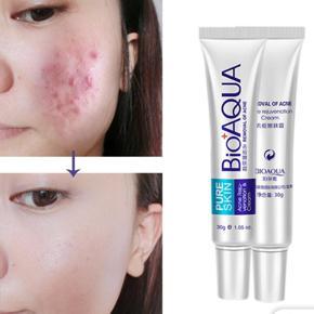 Pure Skin Face Care Acne Cream Treatment Scar Removal Cream