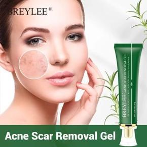 BREYLEE Acne Scar Removal Gel Fade Acne Marks Spots Remove Skin Pigmentation Soothing Prevent Acne Treatment Serum Essence -30gm