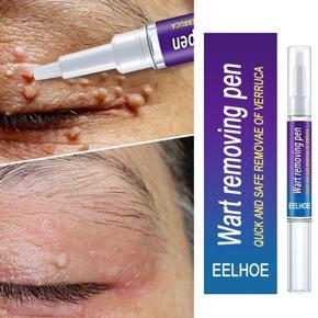 Beauty Health Skin Care Removal Of Warts Liquid Warts Remover Pen Removing Against Moles Anti Verruca Remedy