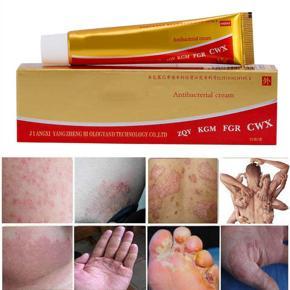 Foot cream extract ointment anti-itch body care frost used for people Daily nursing Skin
