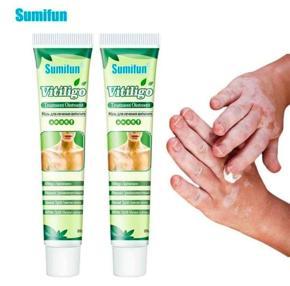 Sumifun Vitiligo Treatment Ointment Cream
